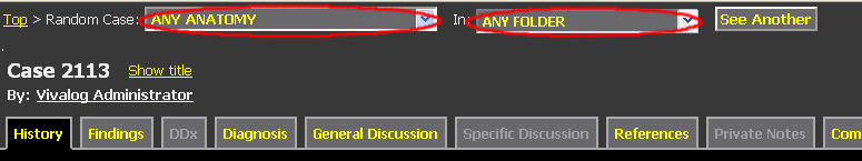 Show dropdown for constraining Random Case